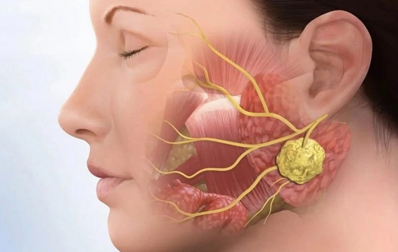 Nguy cơ tiềm ẩn và cách giảm đau khớp thái dương hàm hiệu quả